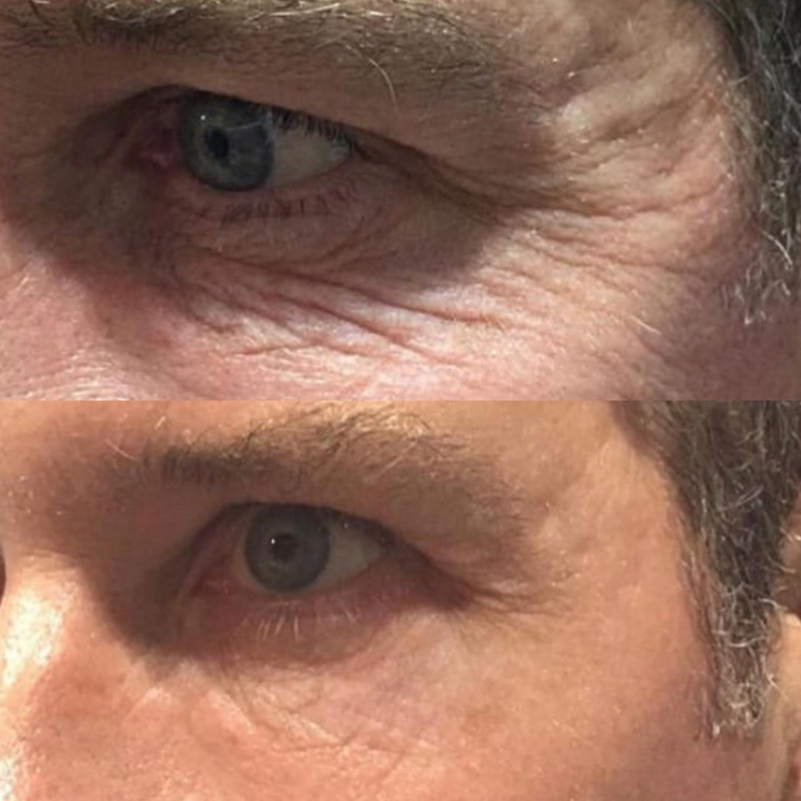 The Treatment -Skin & Hair Booster