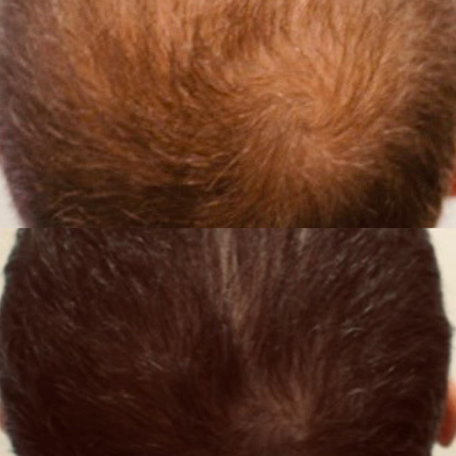 The Treatment -Skin & Hair Booster